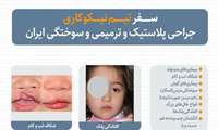 حضور تیم نیکوکاری جراحی پلاستیک، ترمیمی و سوختگی ایران جهت درمان کودکان و بیماران نیازمند در شهرستان فسا در آینده نزدیک